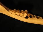 best place for dental implants